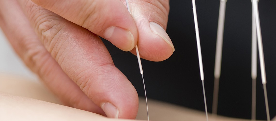 Chiropractic Acupuncture from Leading Experts